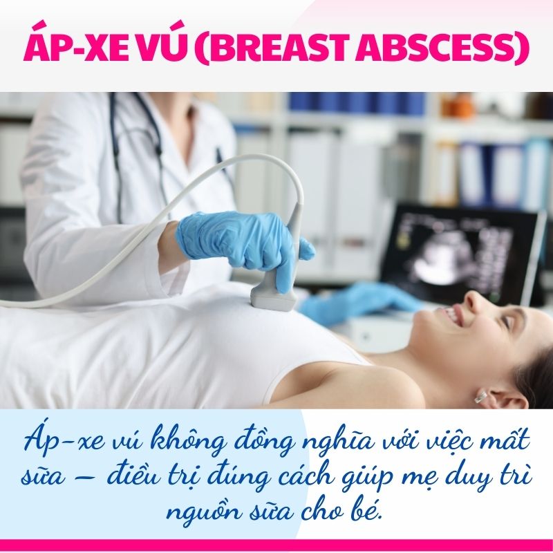 Siêu âm điều trị áp xe vú thông tắc tia sữa